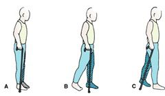 拐杖,圖解,注意事項(xiàng),方法