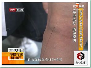 身體放血后注意事項