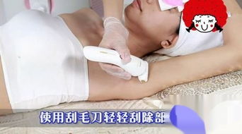 脫毛,激光,注意事項(xiàng)