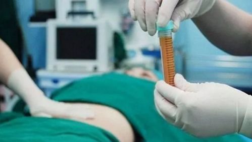 一個(gè)月,移植,注意事項(xiàng)