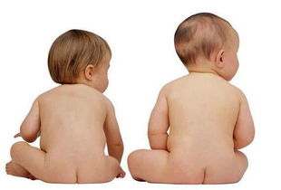 剖腹產(chǎn)第一天注意事項(xiàng),剖腹產(chǎn)前注意事項(xiàng),剖腹產(chǎn)后坐月子注意事項(xiàng)