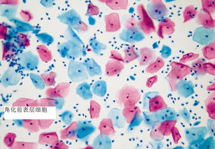 簡單染色法注意事項