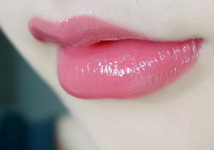 水晶潤唇術(shù)后注意事項(xiàng)