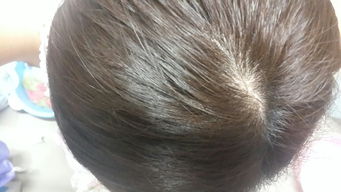 頭發(fā),注意事項(xiàng)