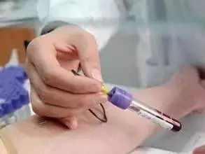 動脈采血的注意事項,采血的要點及注意事項,靜脈采血注意事項8條