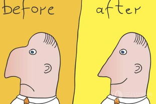 隆鼻,濟南,修復,注意事項