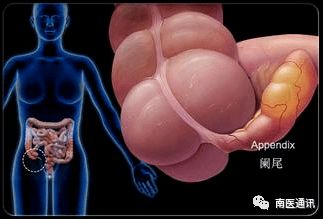 做了闌尾炎手術(shù)后要注意什么飲食,闌尾炎微創(chuàng)手術(shù)后飲食注意事項(xiàng),闌尾炎輸液后飲食注意事項(xiàng)