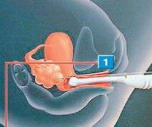 做完,注意事項(xiàng)