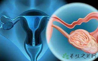 發(fā)生性關(guān)系有什么注意事項(xiàng)