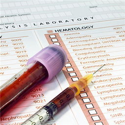 血粘度高的飲食注意事項,驗血粘度注意事項,粘度的測定注意事項