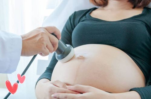 監(jiān)測,注意事項,胎心