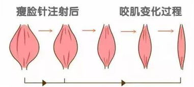 第一次打針注意事項(xiàng)