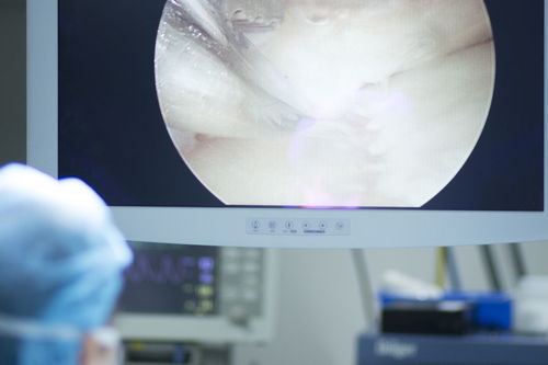 鰓裂囊腫注意事項(xiàng)