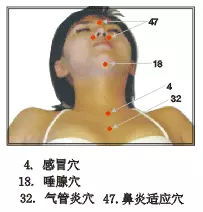 瀉血拔罐注意事項(xiàng)
