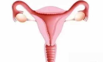 丅型環(huán)取環(huán)注意事項(xiàng)