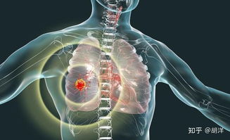 后應(yīng),注意事項(xiàng),手術(shù)