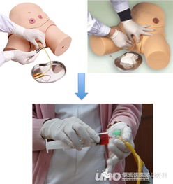 膀胱灌注化療注意事項(xiàng)中錯(cuò)誤的是,膀胱灌注化療注意事項(xiàng)醫(yī)學(xué)生教育,膀胱灌注化療藥物注意事項(xiàng)