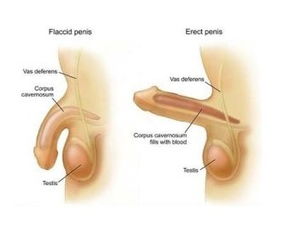 長沙的陰莖延長術(shù)日常注意事項(xiàng)有