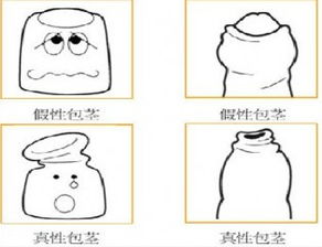 包莖手術(shù)過后的注意事項(xiàng)是哪些,割完包莖注意事項(xiàng),男士割包莖注意事項(xiàng)