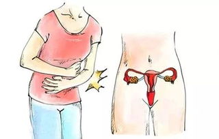 子宮壁厚清宮術(shù)后的注意事項