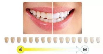 beyond冷光美白注意事項(xiàng)