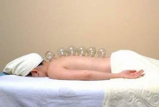 拔罐注意事項(xiàng)和禁忌癥