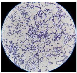 鏈球菌屬鑒定試驗注意事項
