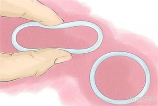 注意事項(xiàng),飲食,帶環(huán)