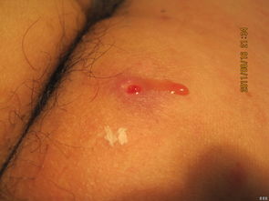 注意事項(xiàng)