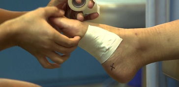 扎火針后的注意事項(xiàng)