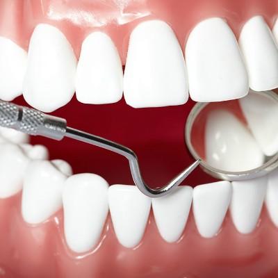 拔牙補牙后的注意事項,拔牙補牙注意事項與禁忌癥,拔牙補牙前注意事項