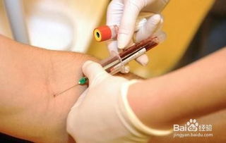 抽血驗(yàn)過(guò)敏源注意事項(xiàng)