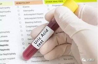 采血前病人的注意事項