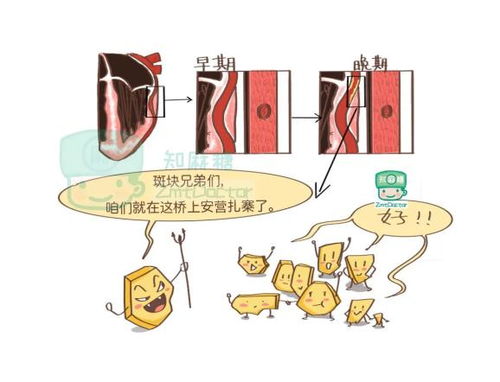 冠心病的注意事項有哪些,冠心病的注意事項有哪些健康一線,冠心病的注意事項有哪些五個