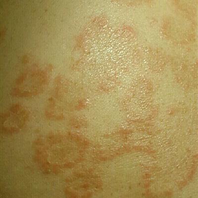 注意事項(xiàng),玫瑰