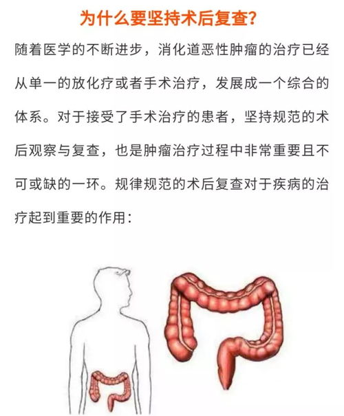 結(jié)腸灌洗的方法和注意事項(xiàng),中藥全結(jié)腸灌洗注意事項(xiàng),結(jié)腸esd術(shù)后注意事項(xiàng)