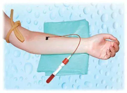 靜脈采血技術注意事項有哪些,靜脈采血技術注意事項及操作風險防范,靜脈采血技術注意事項題