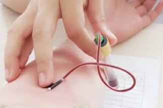 腎功能檢查前注意事項,腎功能檢查項目有哪些,腎功能檢查哪些項目需要空腹嗎