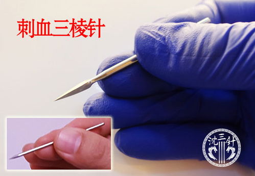 舌根放血后注意事項,放血后注意事項不能吃,針灸放血后注意事項