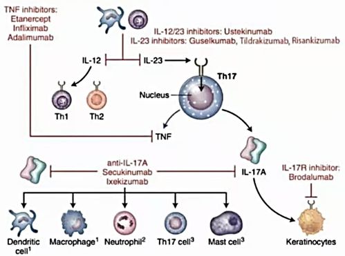 打生物制劑后的注意事項(xiàng)及禁忌,生物制劑輸注注意事項(xiàng),銀屑病生物制劑注意事項(xiàng)