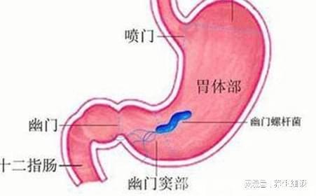 反流性胃炎注意事項,糜爛性胃炎注意事項,反流性胃炎飲食注意事項