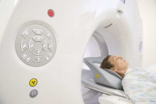做頭部ct前注意事項