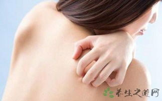 蕁麻疹,注意事項(xiàng),冷激性