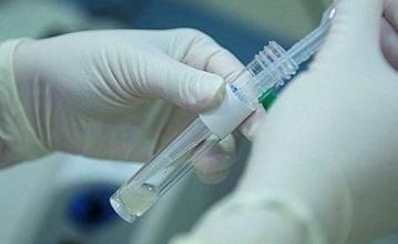 檢測(cè)精子前注意事項(xiàng)