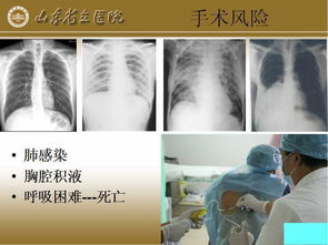 纖維瘤術(shù)后注意事項,肩胛骨纖維瘤注意事項,纖維瘤切除術(shù)后注意事項