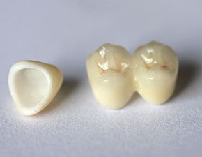 戴牙冠后注意事項,做了臨時牙冠注意事項,裝牙冠后注意事項