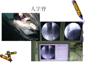 鎖骨,操作流程,注意事項(xiàng)