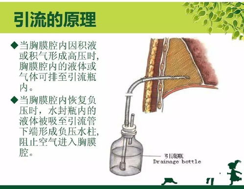 胸膜,引流,注意事項,護理