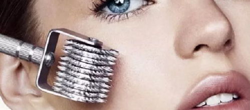 打完微針注意事項