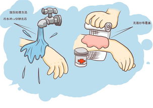 燙傷注意事項(xiàng)和飲食,燙傷恢復(fù)期注意事項(xiàng),燙傷的護(hù)理及注意事項(xiàng)